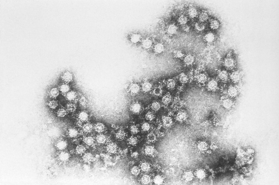 The+Coxsackie+virus+viewed+under+an+immunoelectron+microscope.+
